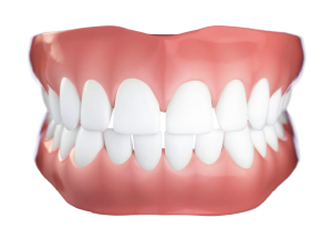 DIASTEMA